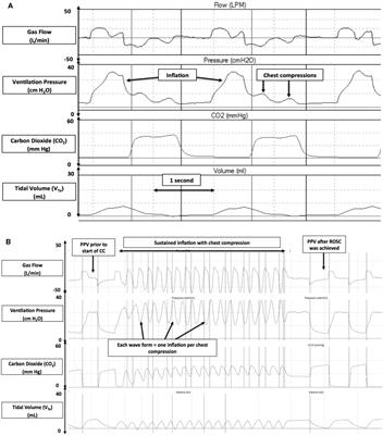 Ventilation Strategies during Neonatal Cardiopulmonary Resuscitation